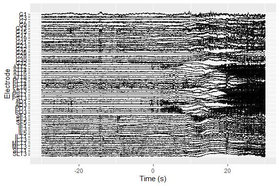 Plot of time series for each electrode