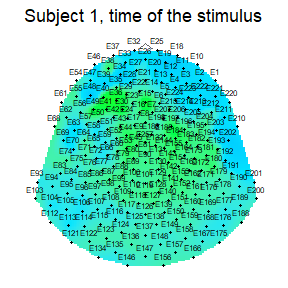 Topographic map of baseline signal